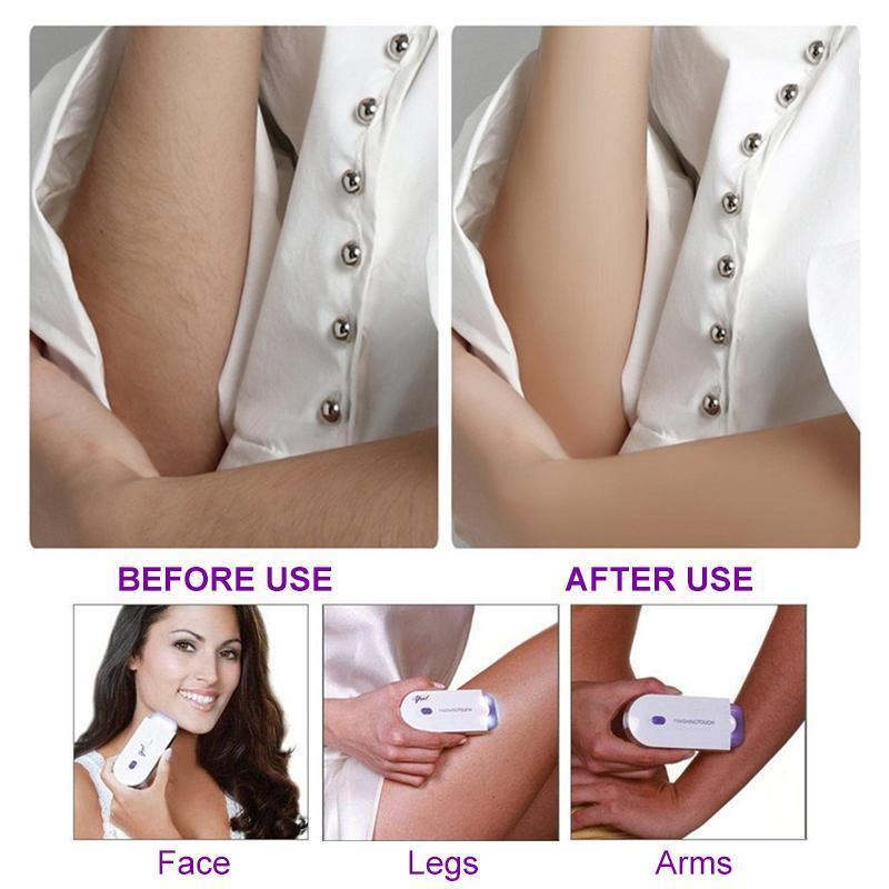🎉Summer Specials🎉Durable and Portable Painless Epilator