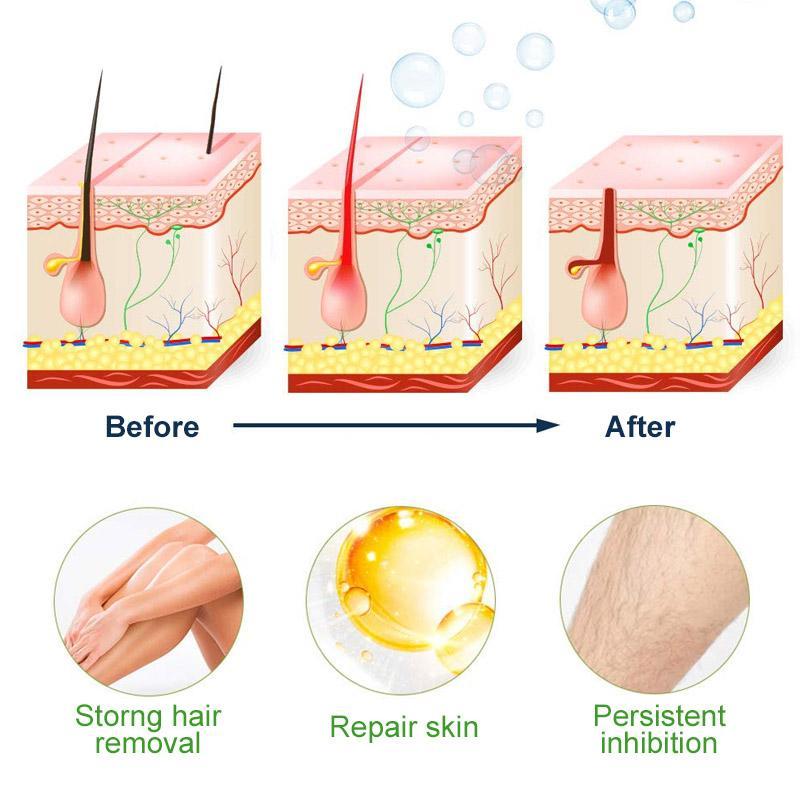 💥Semi-Permanent Hair Removal Spray💥